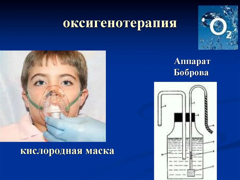 Подача кислорода через маску. Аппарат Боброва при оксигенотерапии. Кислородотерапия аппаратом Боброва. Аппарат Боброва для оксигенотерапии при коронавирусе. Подача кислорода алгоритм аппарат Боброва.