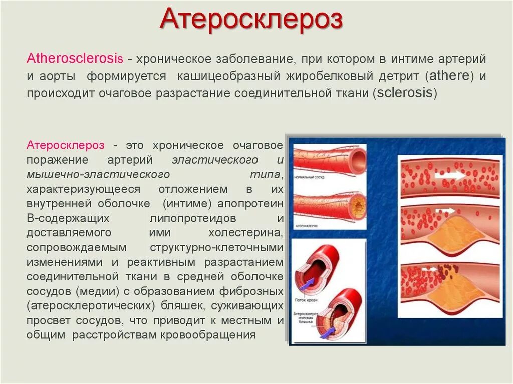 Атеросклероз презентация. Атеросклеротические сосудистые поражения. Хроническое заболевание сосудов