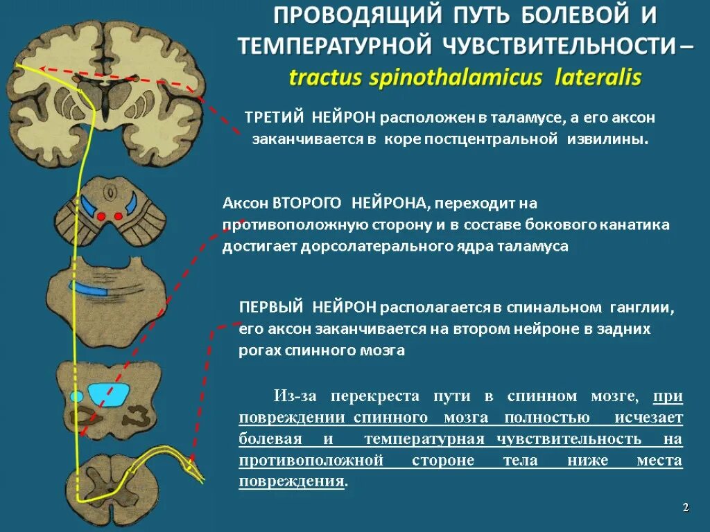 Спинно таламический путь. Проводящие пути болевой и температурной чувствительности. Проводящий путь осязательного анализатора. Болевая температурная и тактильная чувствительность проводящие пути. Проводящие пути чувствительного анализатора.