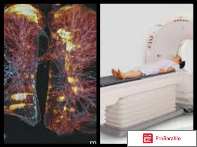 компьютерная рентгеновская томография грудной клетки пневмония. мрт женщина. компьютерная томография снимки. снимок мрт легких. магнитно резонансная томография диагностика опухолей.