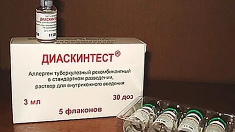 Диаскинтест сделать платно
