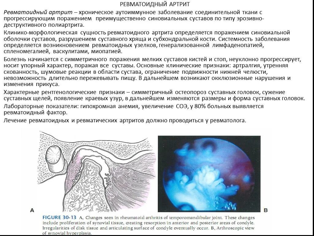 жалобы больного ревматоидным артритом. лечение острого подагрического приступа. подагрический артрит обострение. неотложная помощь при остром подагрическом артрите. протокол питания ревматоидный артрит.