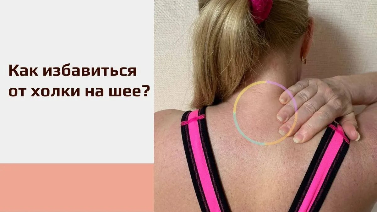 Как убрать горб на шее. Упражнения против холки на шее.