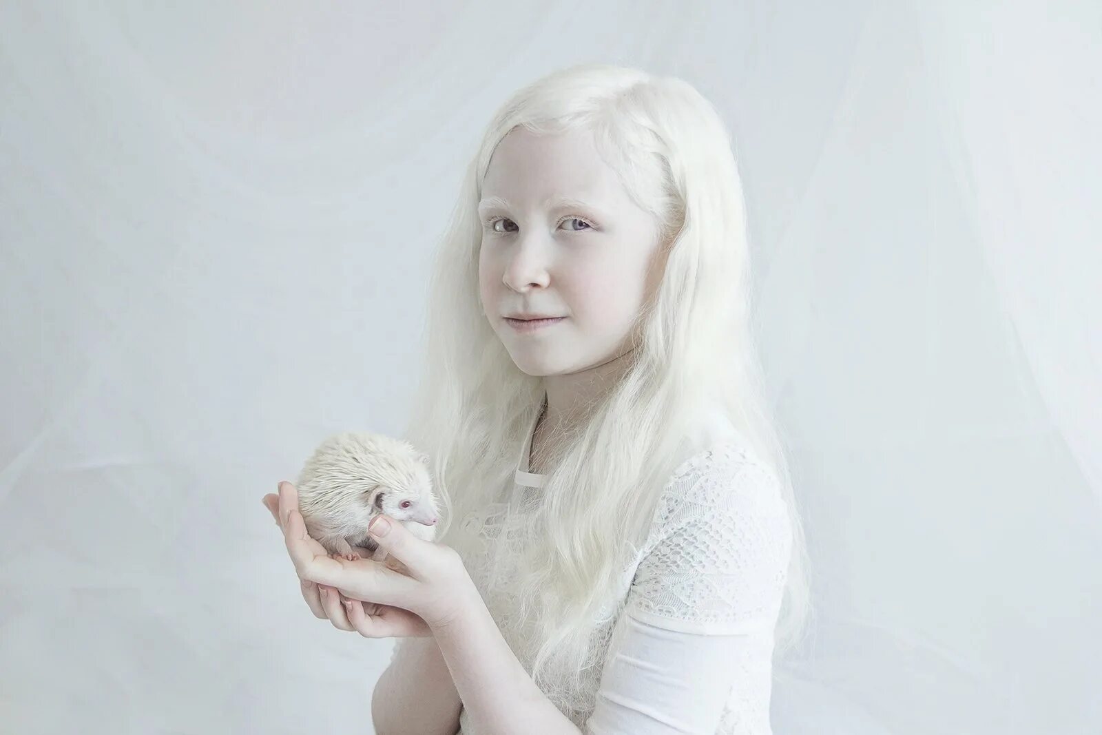 Саша Смирнов альбинос. Седые альбиносы.