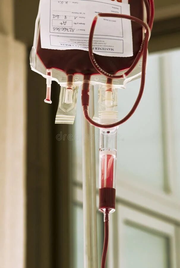 Переливание крови при каком гемоглобине. Пакет с кровью для переливания. Капельница для переливания крови с фильтром.