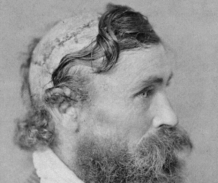 Индейцы америки скальпирование. Индеец отрезающий скальп. Снятие скальпа индейцами. Человек после скальпирования. Скальп и индейцы скальпирование.