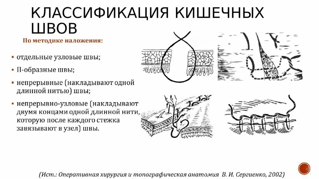 Классификация кишечных швов. Абдоминальная операция что это