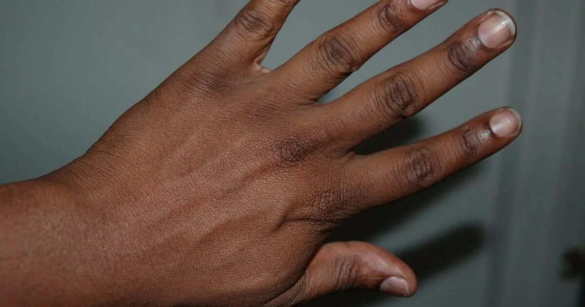 Зачем людям пальцы. Десять пальцев на руке. Полидактилия верхних конечностей. Указательный палец короче безымянного. Щелканье пальцами вредная привычка.