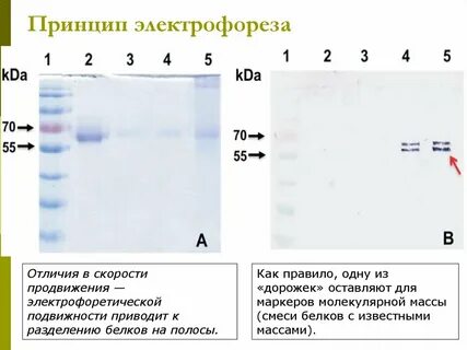 Электрофорез белков принцип метода