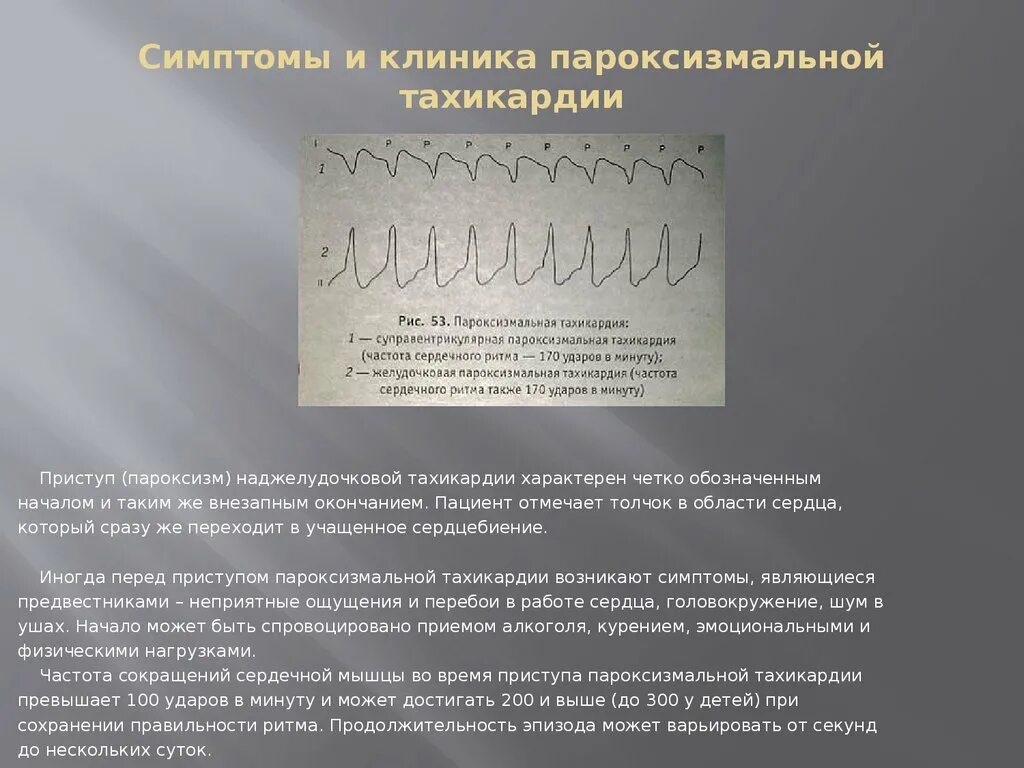 Пароксизм это простыми словами. Предсердная пароксизмальная тахикардия клиника. Приступ пароксизмальной тахикардии клиника. Пароксизмальной наджелудочковой тахикардии. Пароксизм желудочковой тахикардии клиника.