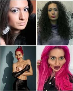 Анастасия покрищук до и после пластики фото