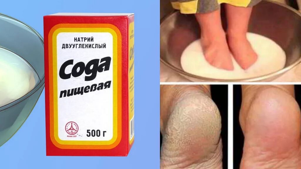 Удалить кожу с пяток