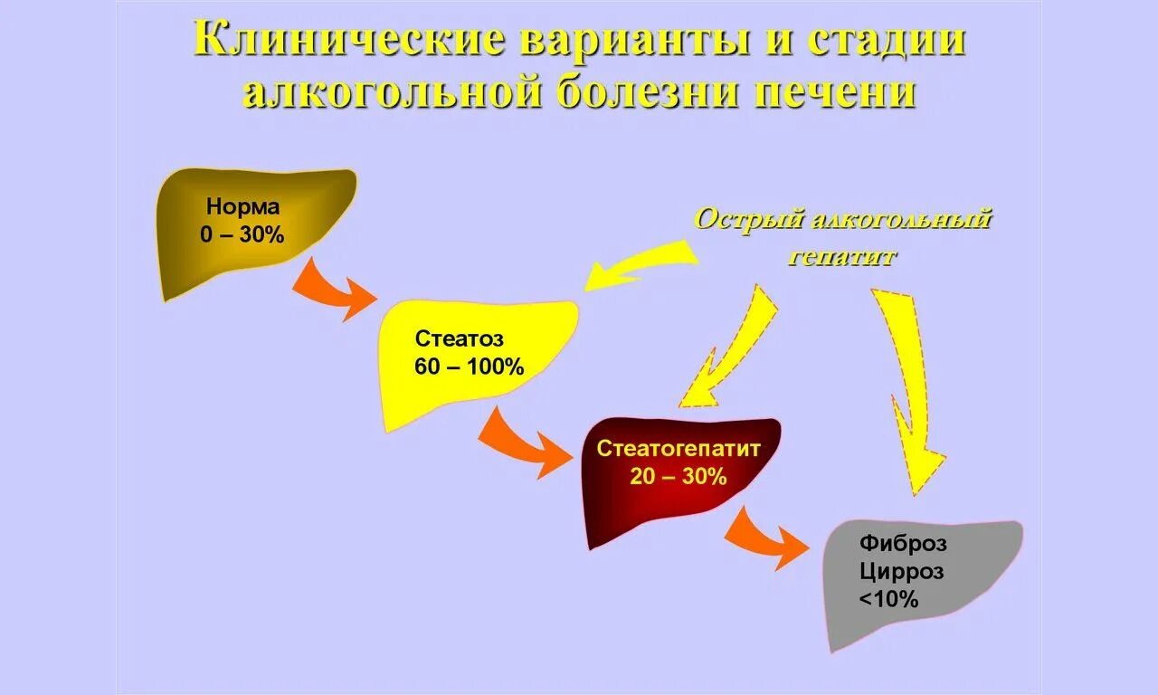 Цирроз печени алкогольной этиологии. Первые симптомы цирроза печени. Терапия алкогольного цирроза печени. Стадии поражения печени алкоголем. Цирроз симптомы у мужчин алкоголиков.