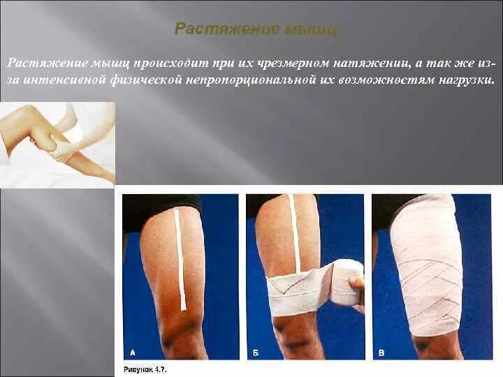 При растяжении мышц необходимо. При растяжении мышц необходимо
