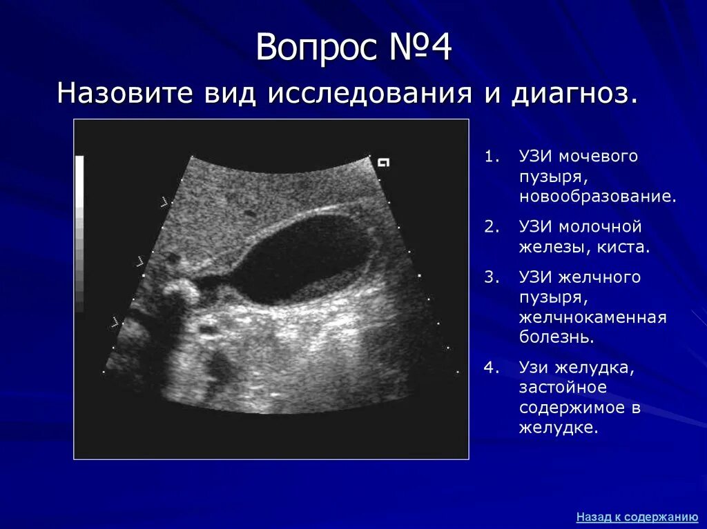 Узи сократимости желчного пузыря. Ультразвуковое исследование желчного пузыря. Ультразвуковое исследование желчный пузырь норма. Слоистая стенка желчного пузыря на УЗИ. УЗИ желчного пузыря и протоков.