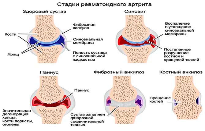 Боль в колене. Болит колено и горит нога. Боль в колене. Болит колено и горит нога. Болит колено и горит нога.