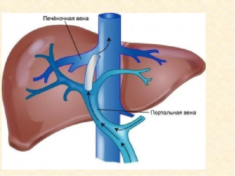 Печень расширены вены. Воротная Вена печени анатомия. Печеночная Вена и воротная Вена. Воротная печеночная и нижняя полая Вена. Тромбоз воротная Вена печени.
