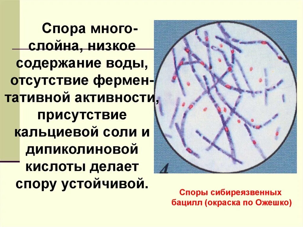 Окраска спор бактерий. Окраска по Ожешко микробиология микроскоп. Споры бацилл по Ожешко. Окраска Ожешко Bacillus anthracis. Сибирская язва окраска по Ожешко.