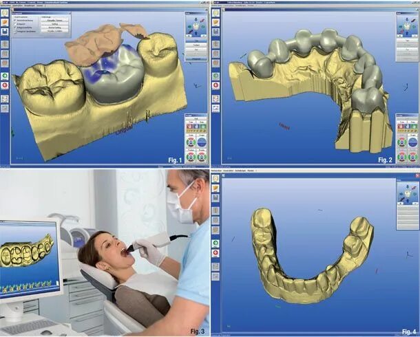 Cad cam моделирование. Cad cam технологии в стоматологии. cad cam технологии в ортопедической стоматологии. технология cad/cam 3д принтеры. 3d моделирование в стоматологии.