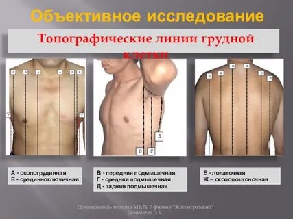 Срединная линия грудины
