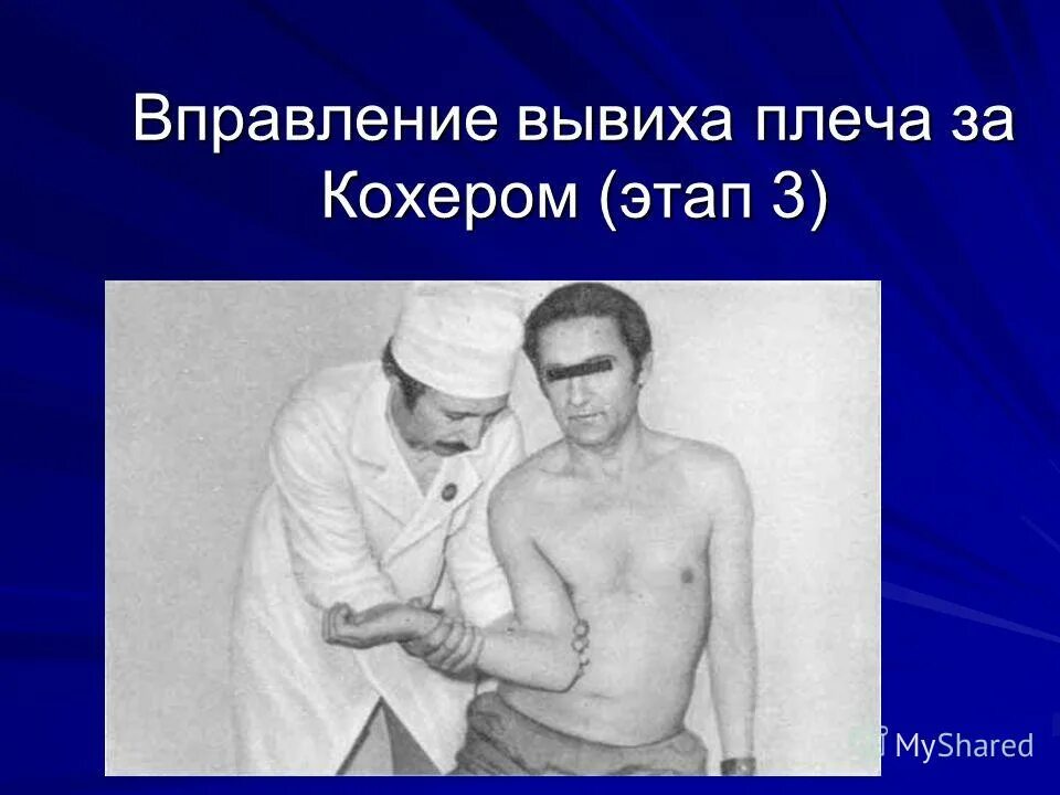 Способ кохера вправление. Метод вправления вывиха плечевого сустава. Вправление вывиха по методу кохера. Вправление вывиха по кохеру. Вывих плеча метод кохера.
