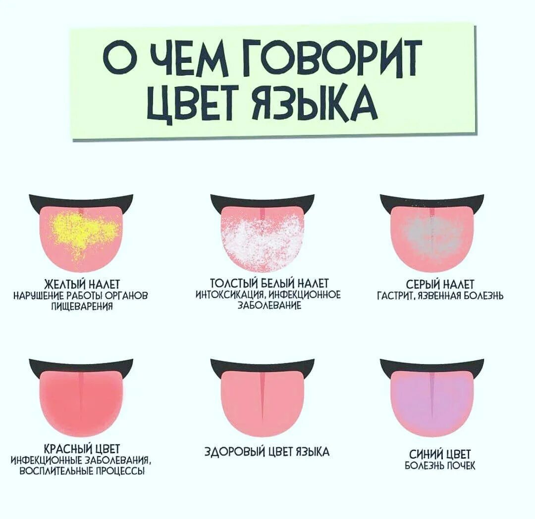 О чем говорит цвет языка у женщин