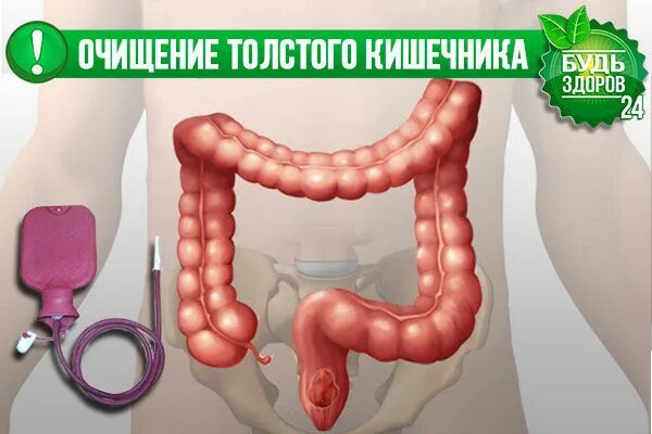 Система очищения кишечника. Вычещение толстой кишки. Очистить толстый кишечник.