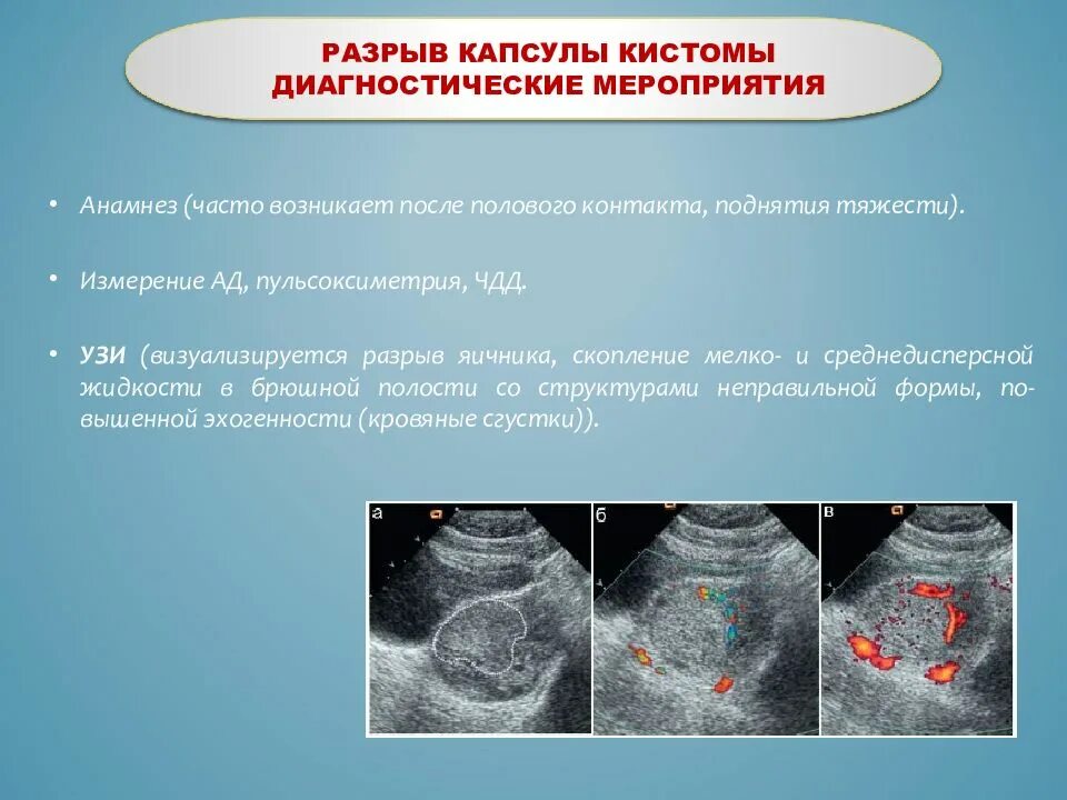 Почему после полового контакта. Разрыв капсулы кистомы. Разрыв яичника симптомы.