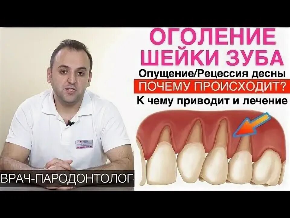 Фотоотбеливание зубов Beyond со скидкой 17% в стоматологическом центре "Доктор р