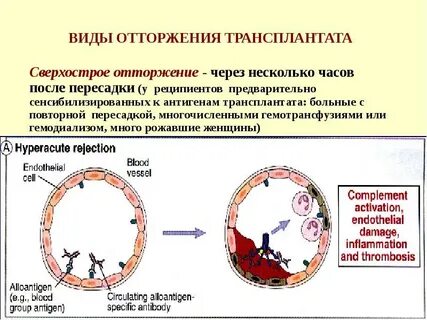 Отторжение от человека