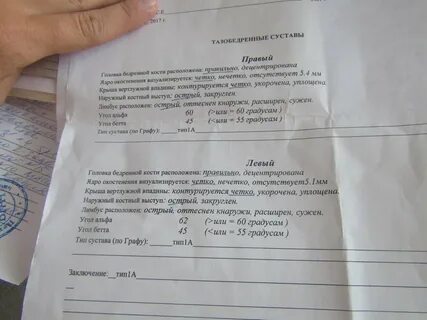Ядра окостенения тазобедренных суставов у детей