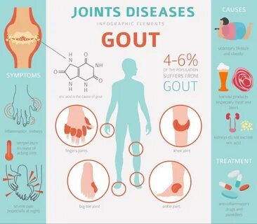 Go causes