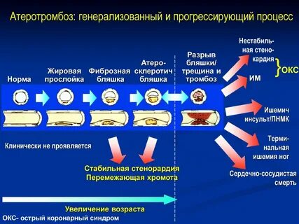 Условие бляшке