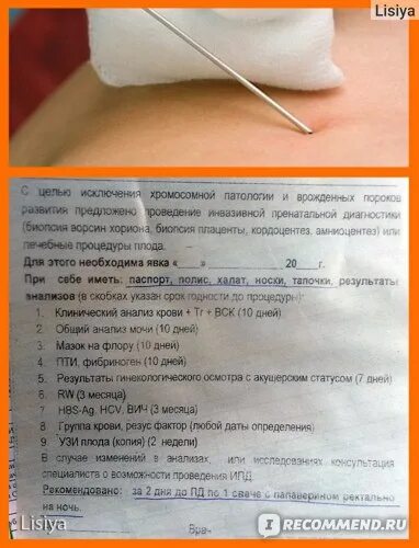 Где сдать анализ биопсии. Результаты биопсии хориона. результат биопсии ворсин хориона. биопсия хориона результаты анализа.