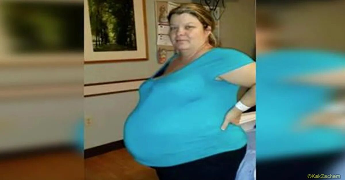 Беременность после 34. Тэмми Юнг до и после с животом.