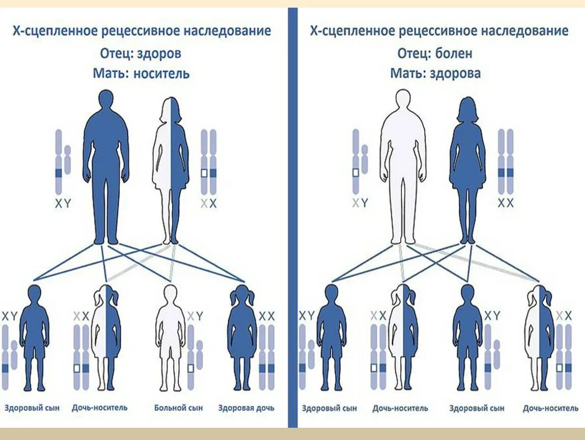 Укажите мужчину гемофилии. Генетическая схема наследования сцепленное с полом. схема наследования генетических заболеваний. наследование болезни гемофилия дальтонизм. схема наследования гемофилии и дальтонизма.