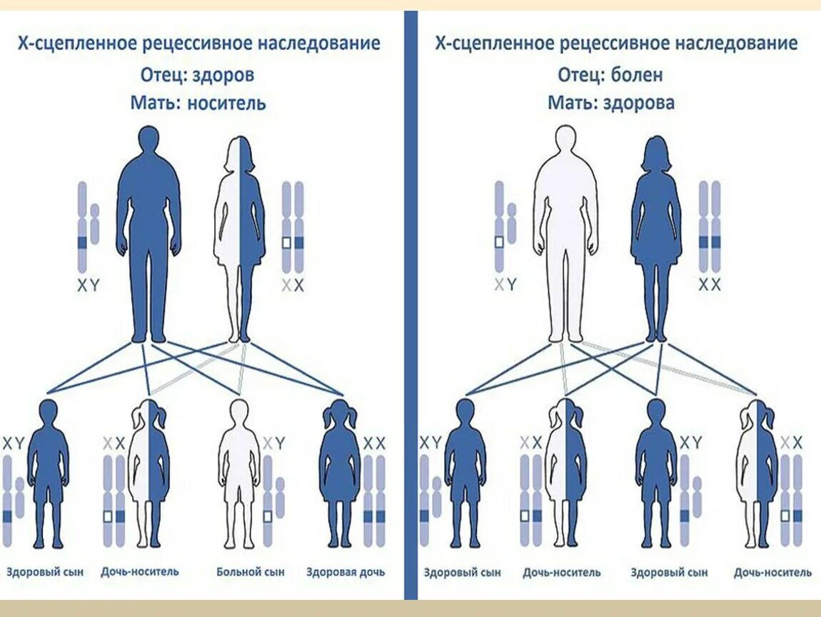 Гемофилия это признак сцепленный с