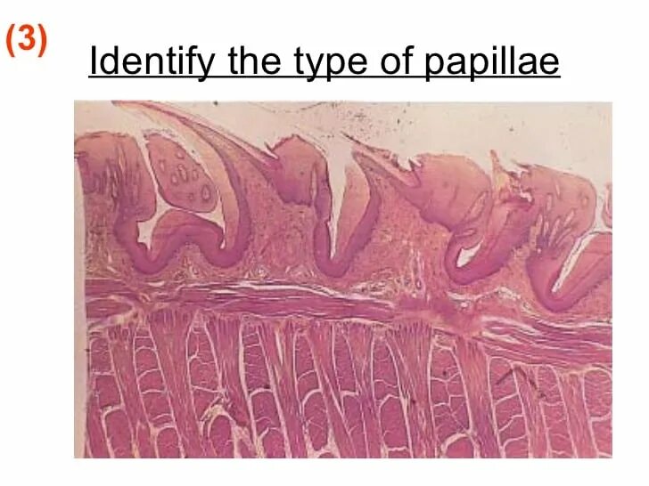 Листовиднвй сосочек язык гистология. Грибовидные сосочки гистология препарат. Язык срез. Язык нитевидный сосочек гистология препарат. Грибовидные сосочки языка препарат гистология.