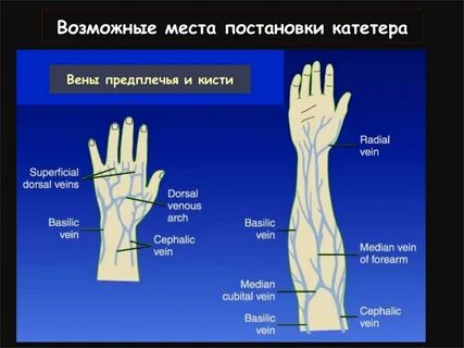 Вена кисти