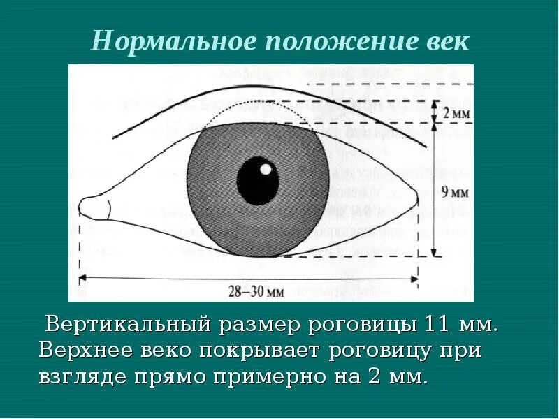 Положение вв