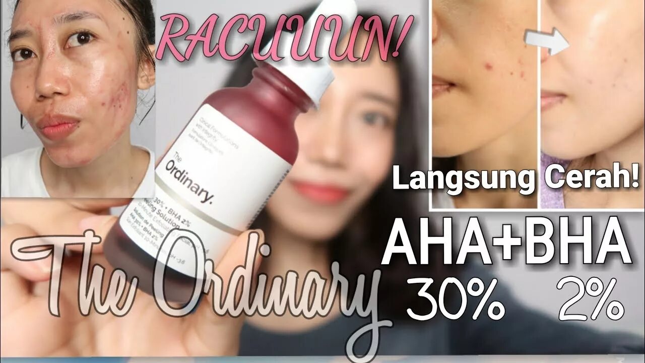 The ordinary Aha 30 BHA 2. The ordinary Aha 30 BHA 2 peeling solution. Кровавый пилинг. Кровавый пилинг корейский. После кровавого пилинга