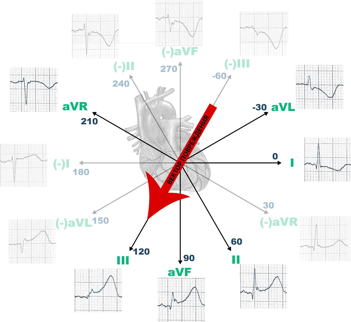 12 Отведений ЭКГ схема. AVR AVL AVF отведения на ЭКГ норма. Отведение AVR на ЭКГ норма. AVL AVF В ЭКГ. Соп экг