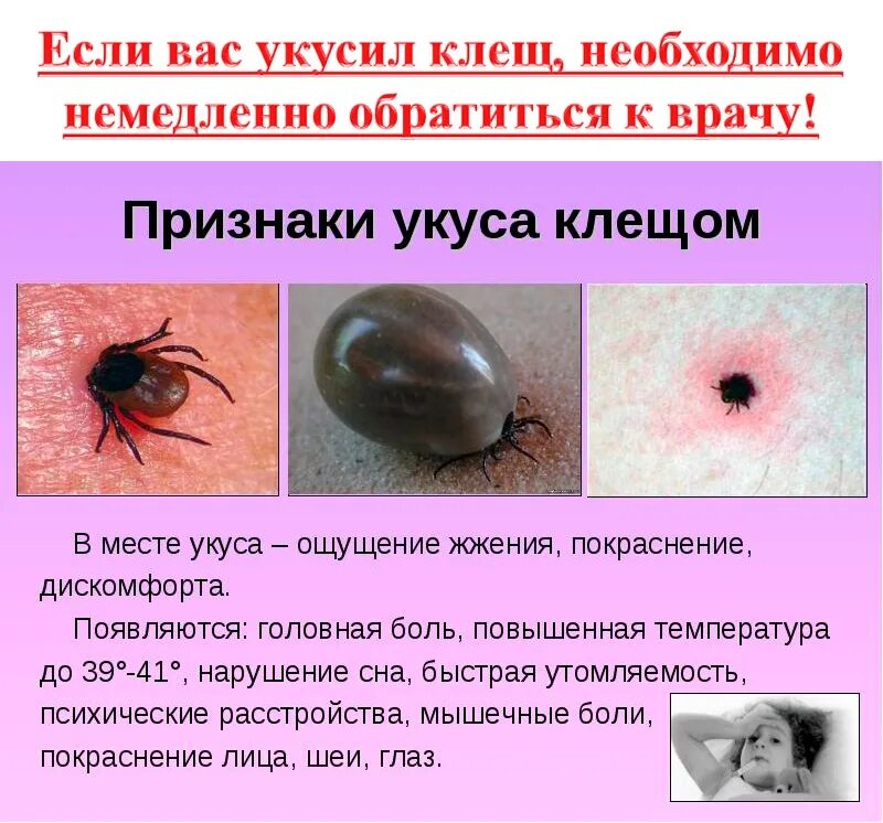 Обнаружение клеща. Как выглядит укус клеща. как выглядит укус зараженного клеща. место после укуса клеща. какак выгвыглядит укус клющека.