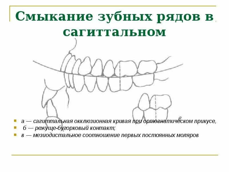 Соотношение зубных рядов