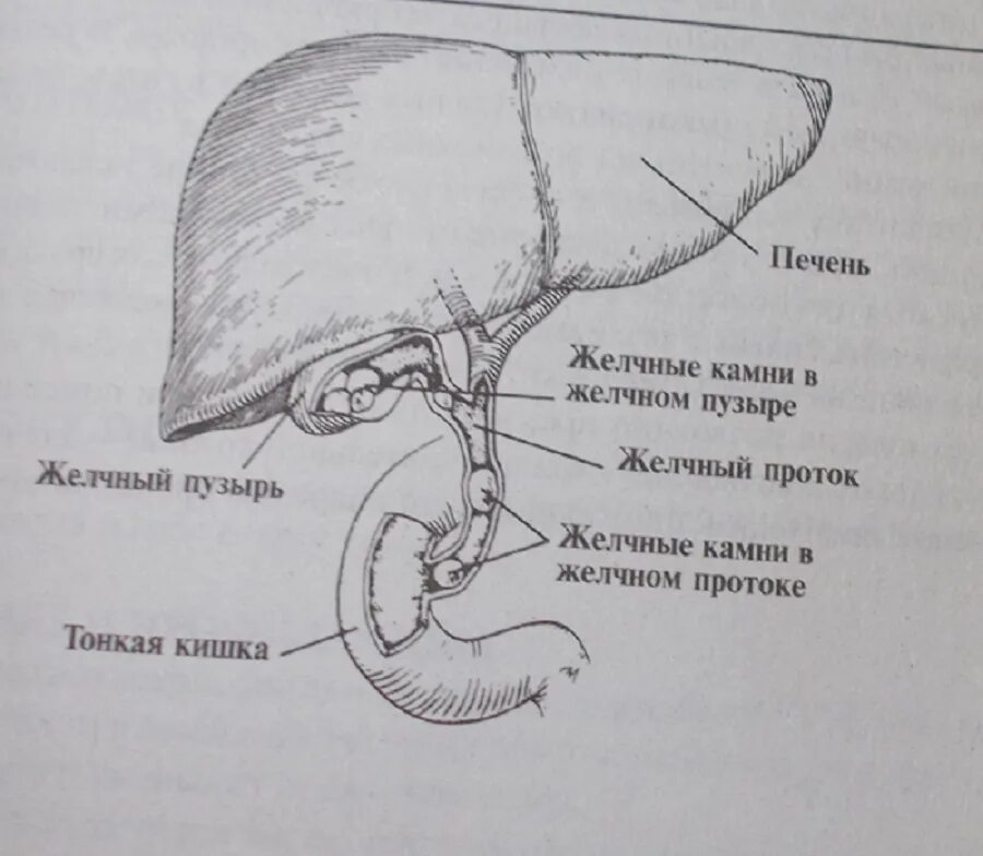 Масло для желчного пузыря