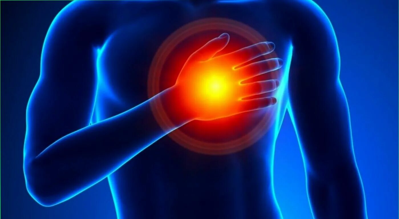 Межреберная невралгия грудной клетки. Стенокардия фото. Напряжение в грудине. Напряжение в грудине. Границы легких анатомия.