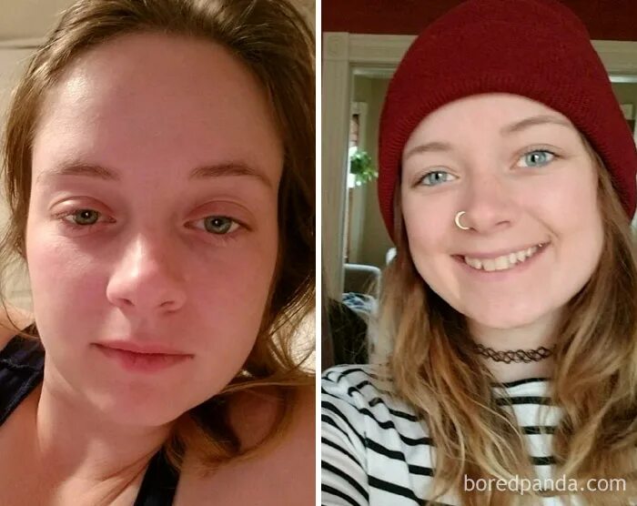 Много изменилась. Пропитое лицо до и после. Пропитое лицо женщины до и после. Лицо до и после алкоголя. Внешность алкоголика до и после.