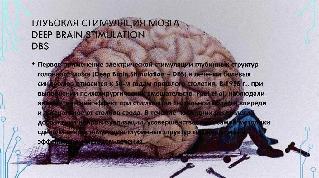 Как стимулировать мозг. Глубокая стимуляция мозга. Глубинная стимуляция мозга. Стимуляция глубинных структур мозга. Система глубокой стимуляции головного мозга.