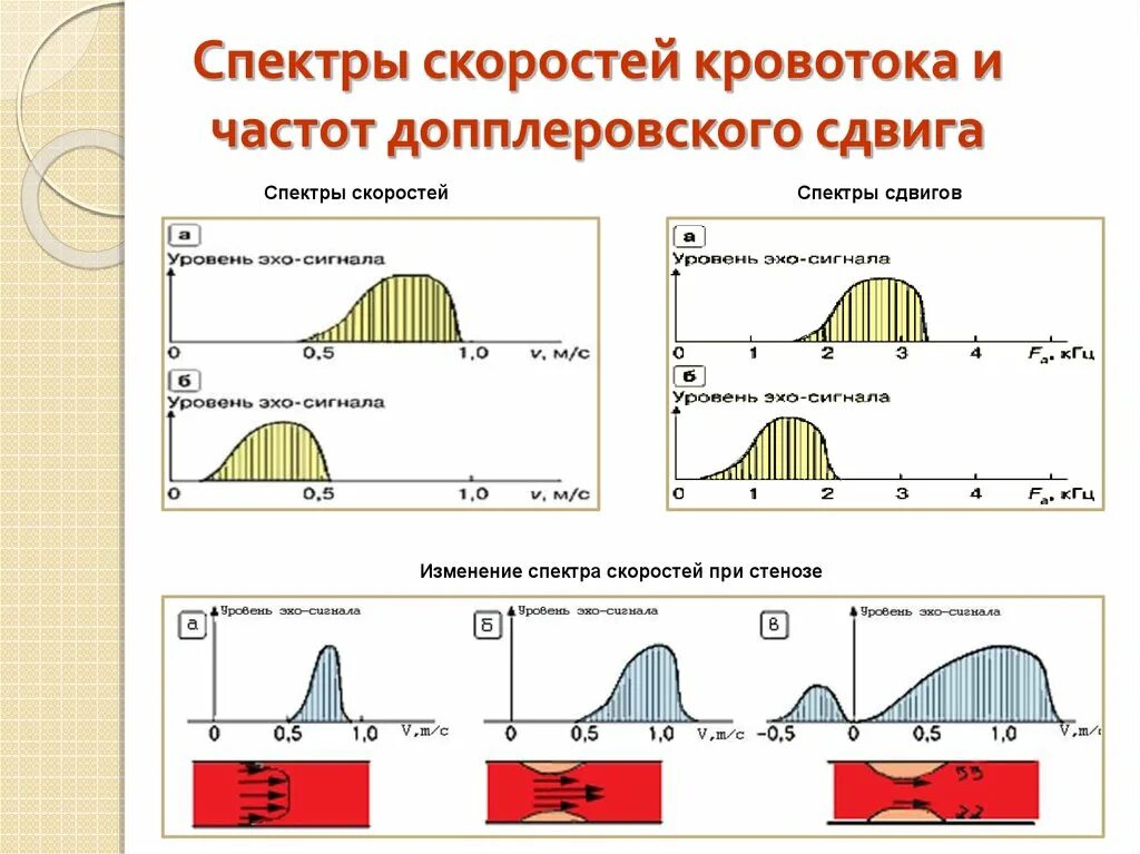 Спектральная характеристика кровотока. Кривые скорости кровотока. Параметры спектра кровотока. Спектр допплеровского сдвига частот.