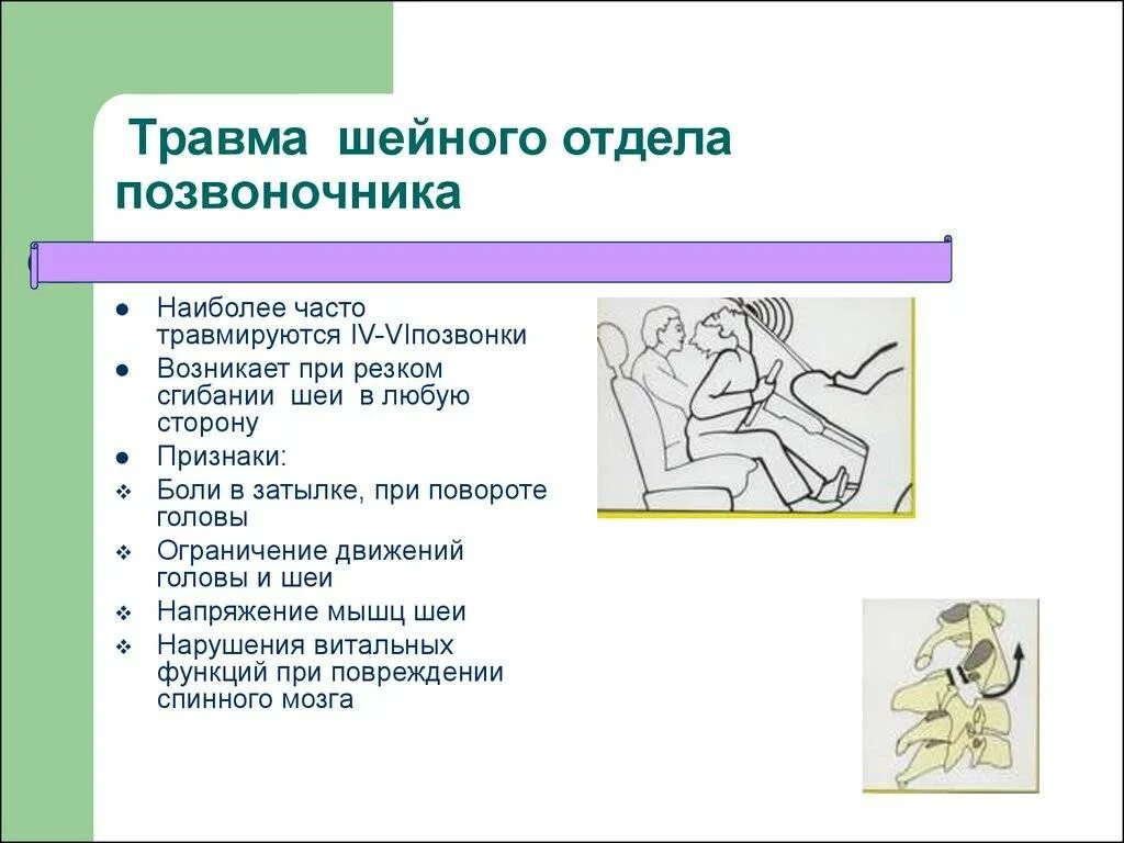 Первая помощь при повреждении шейного отдела позвоночника. Первая помощь при травме шеи и позвоночника. Травма шейного отдела позвоночника. Оказание первой помощи при травме шейного отдела позвоночника.